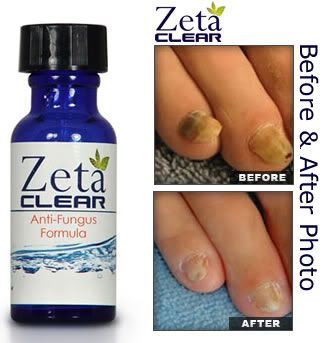oral solution that is FDA registered for safe toenail fungus treatment