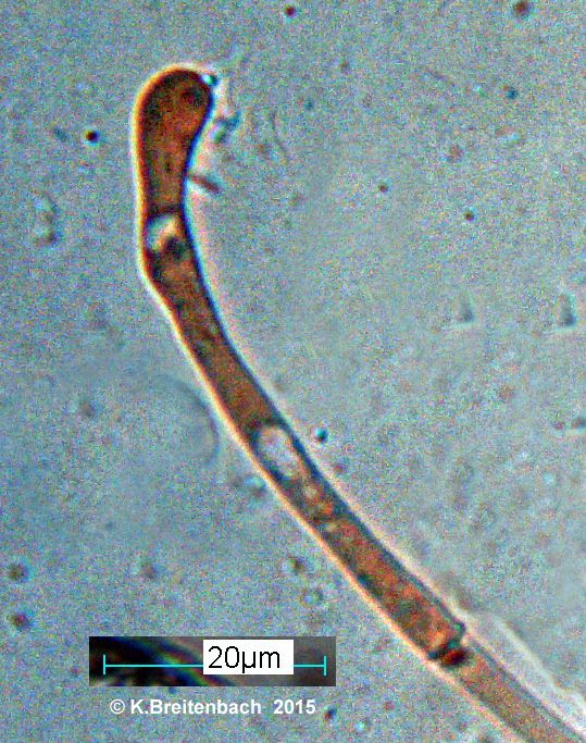  photo Paraphyse einzeln.jpg