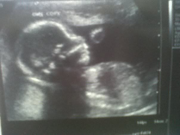 Babyscan-18211-20w2d.jpg